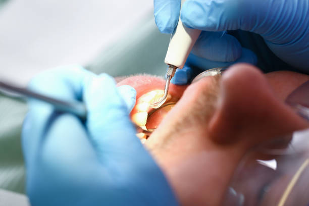 Best Emergency Dental Care for Trauma or Injury in Forest Heights, TX